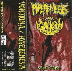 Download Vomitoma Hyperemesis - Split Tape