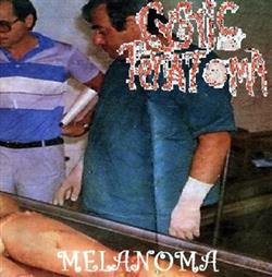 lataa albumi Cystic Teratoma - Melanoma